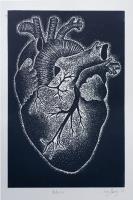 Anterior by Izzy Henry